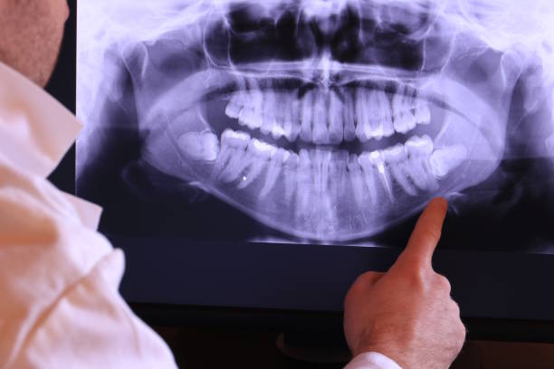 Best Emergency Root Canal Treatment in Redwood Valley, CA